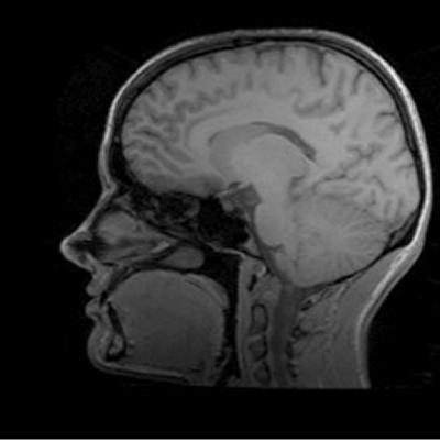 Imaging the human brain