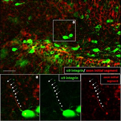 Image taken using fluorescent microscope showing nerve fibre re-growth in high resolution