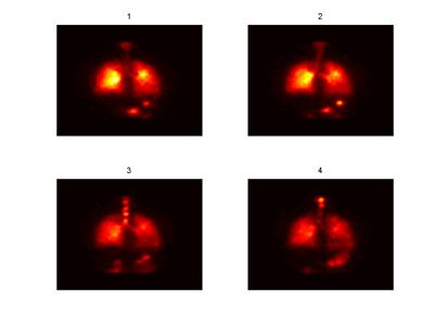 Example planar clearance images for 4 time points, clearly showing the clearance of the radio labelled marker from the lung.
