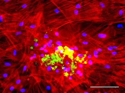 Image courtesy of Bone and Joint Research Group, Centre for Human Development, Stem Cells and Regeneration, University of Southampton