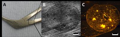 Protein attachments to surface imperfections 