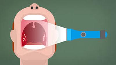 Throat swab