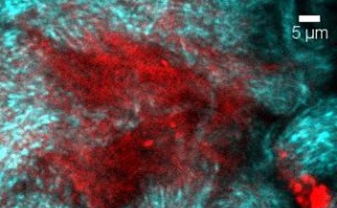 image supplied by Dr Mahajan