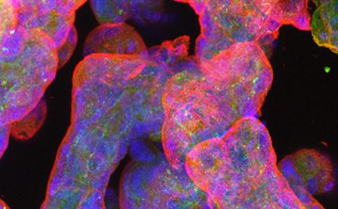 Glutamate transporters in villi