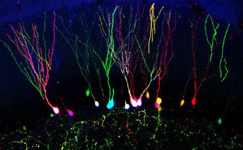 Retroviral tracing of new neurons