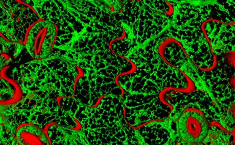 leaf epidermal cells image