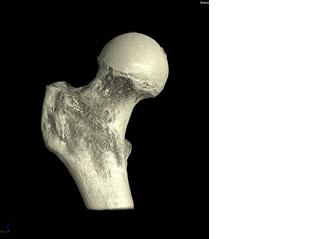 What is Involved for Bone Samples