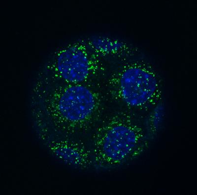 Regulation of endocytosis 