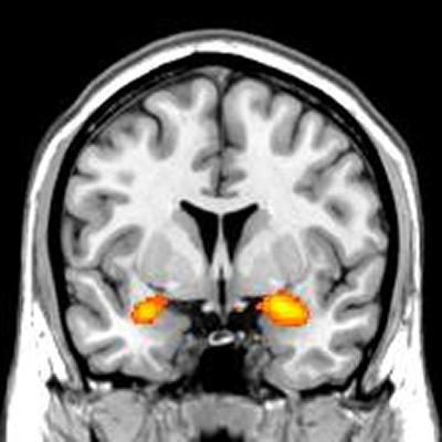 Brainscan image