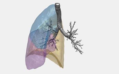 CT scan data lung structure