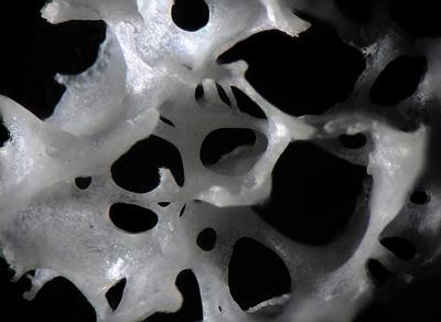 Human trabecular bone
