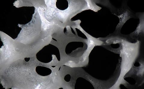 Human trabecular bone