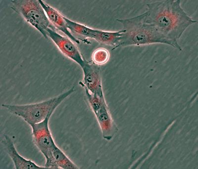 Skeletal stem cells