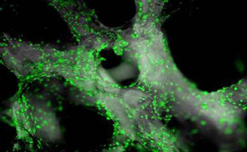 Skeletal stem cells on human bone