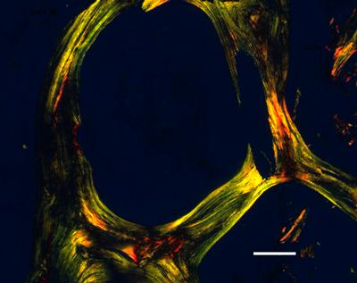 Human trabecular bone