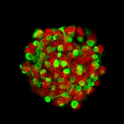 Neural stem cells