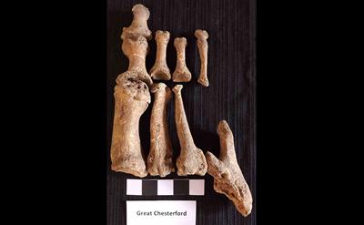 Great Chesterford skeletal remains