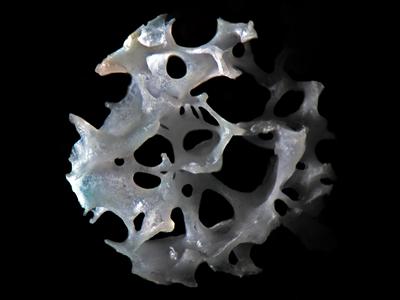 Human trabecular bone