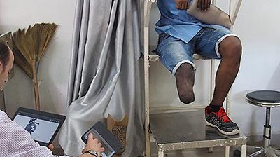 Prosthetic Limb
