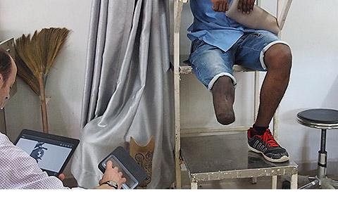Prosthetic Limb