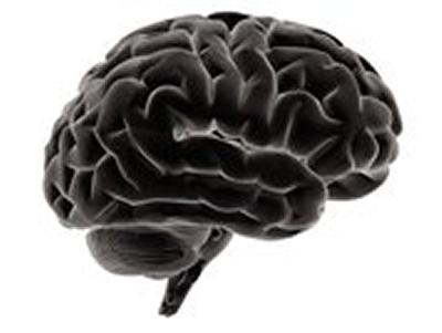 The human brain