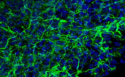 Immunoflourescence staining