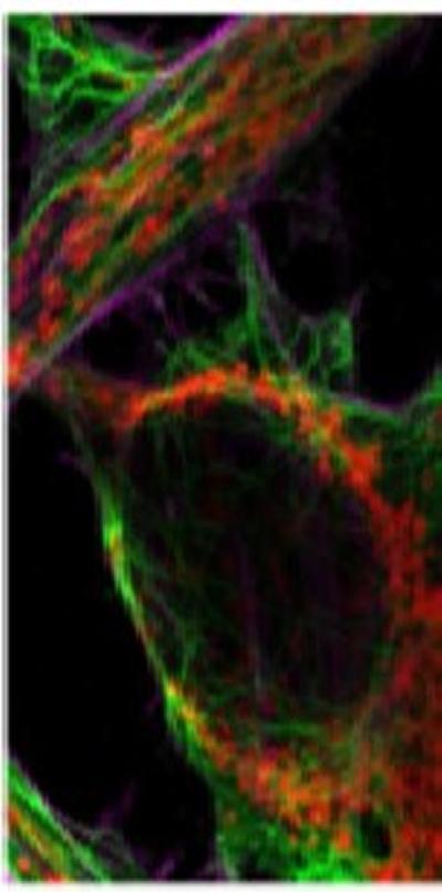 zeiss-bio-imaging-symposium | Centre for Human Development, Stem Cells ...