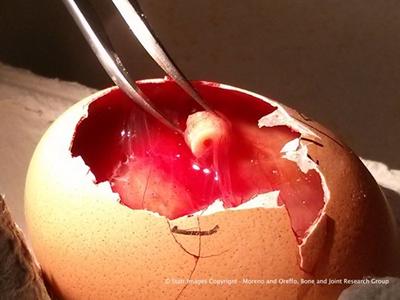 Cylinder of human bone tissue