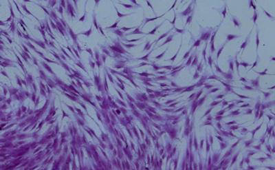 Enriched skeletal stem cells