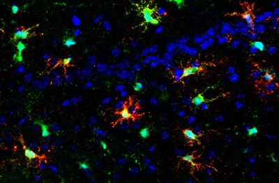 Microglia
