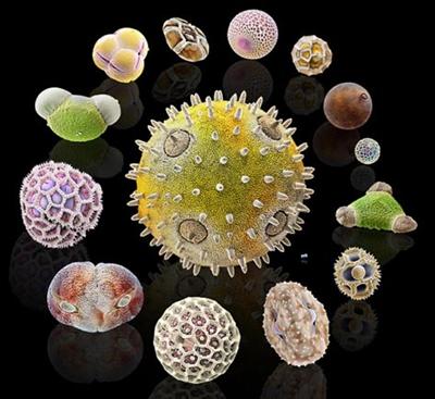 Scanning electron microscope images