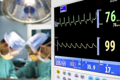 Picture of heart monitor
