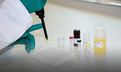 Antibody test