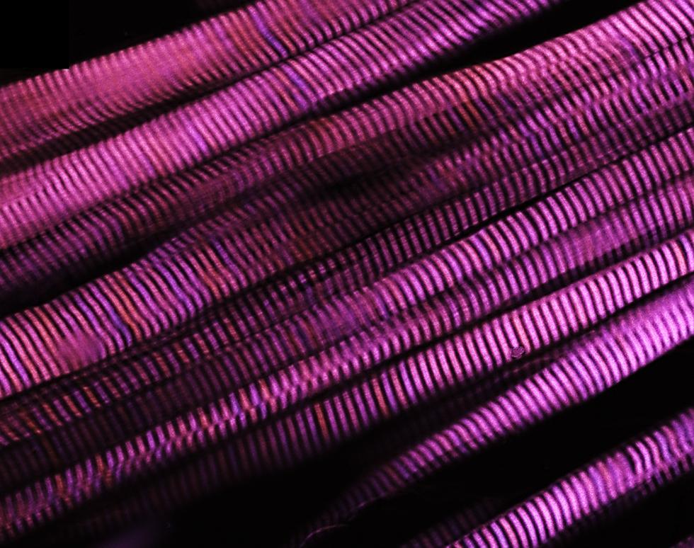 Collagen Fibres - Shmma Quraishe