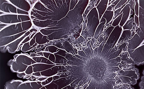 Photo of biofilm formation