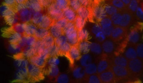 Ciliated airway cells