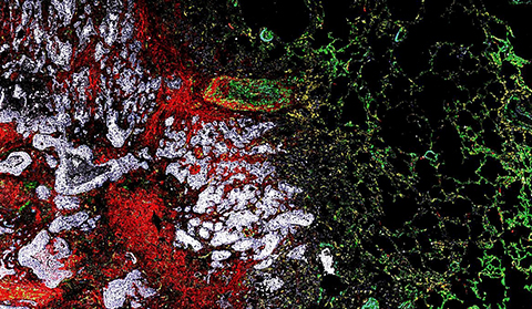 Image of myofibroblasts (red)