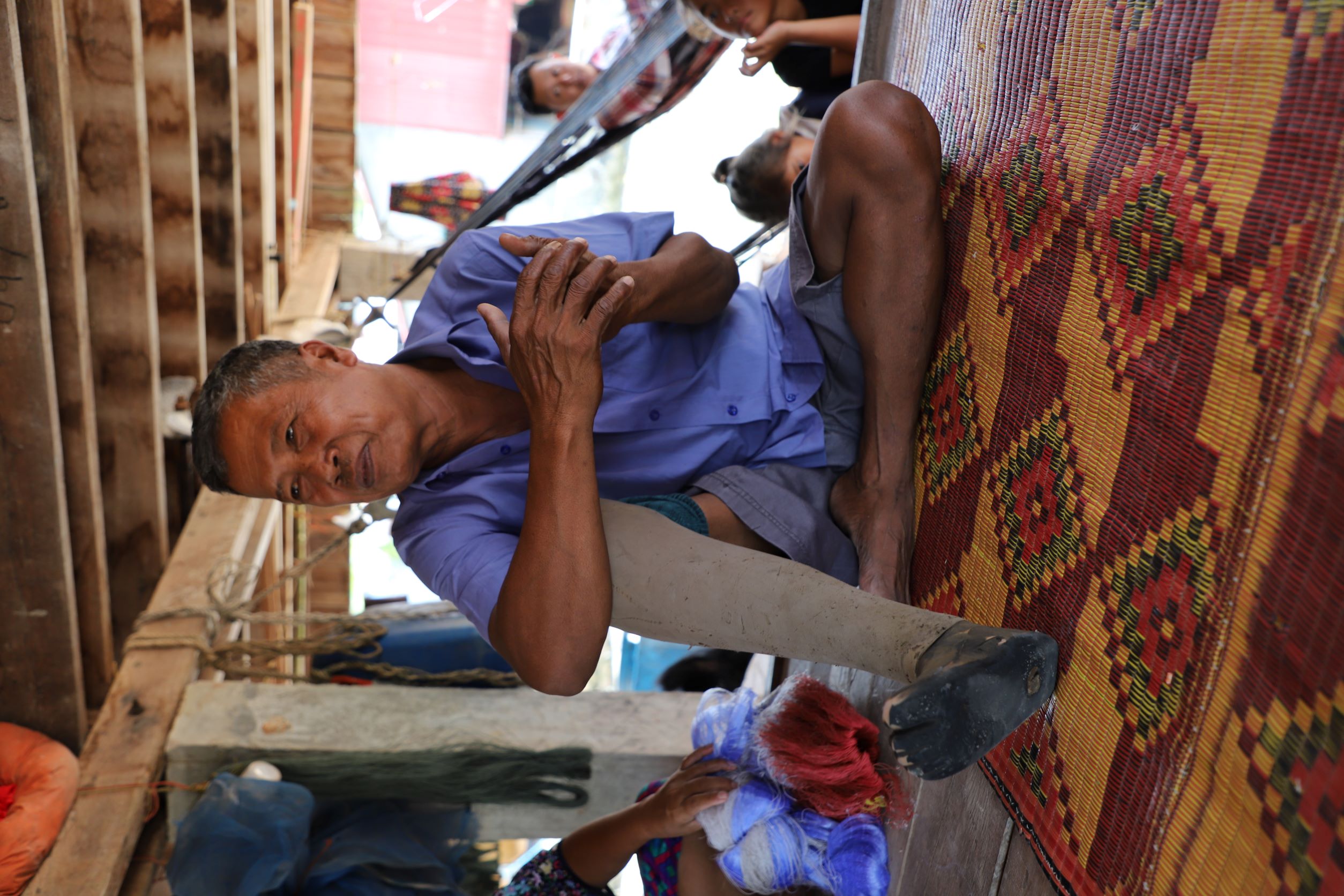 Man sat with prosthetic leg