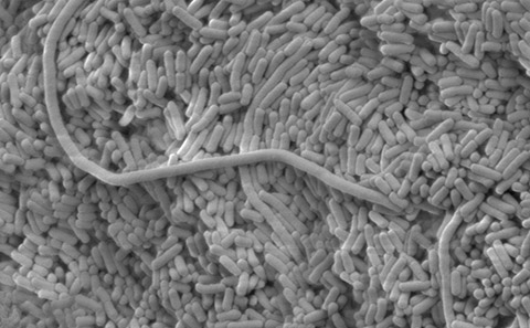 Black and white microscope image of bacteria.