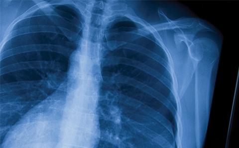 X ray