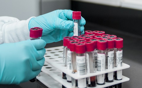 Blood samples