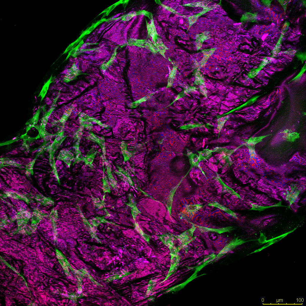 Regenerative medicine