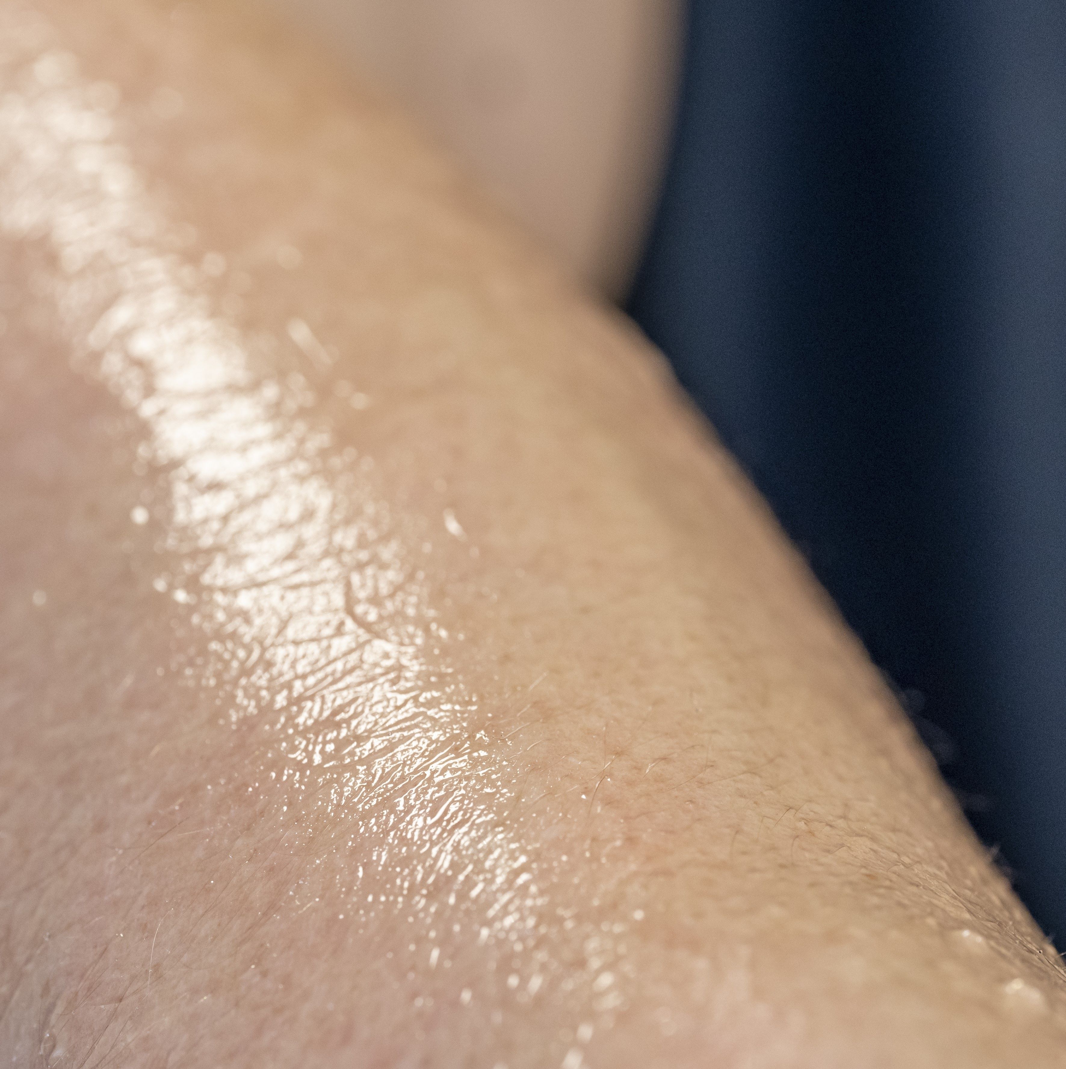 Forearm covered in sweat