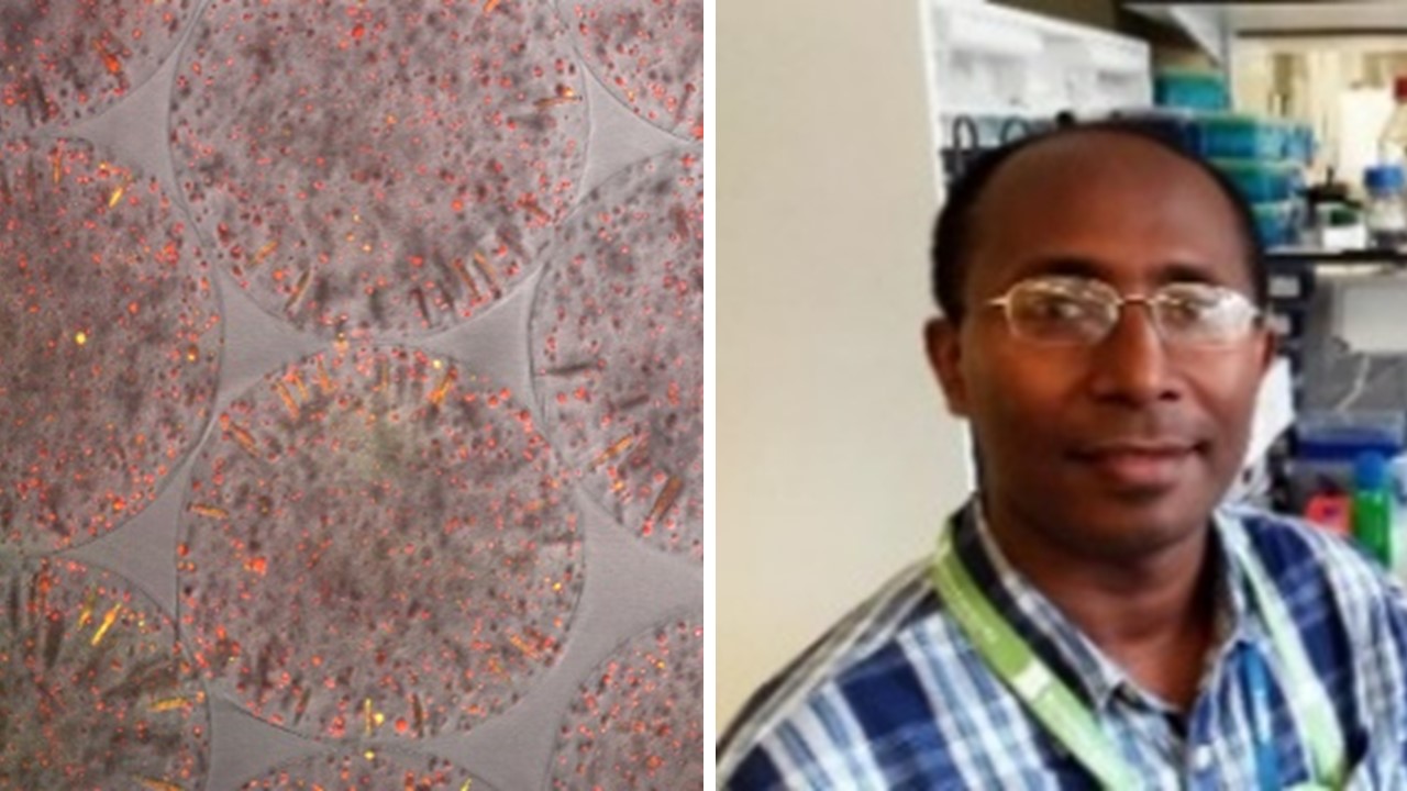 Left: Cells (red) & degraded collagen (yellow). Right: Liku Tezera