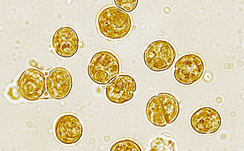 Unicellular symbiont algae of coral. Credit: Wiedenmann/D'Angelo