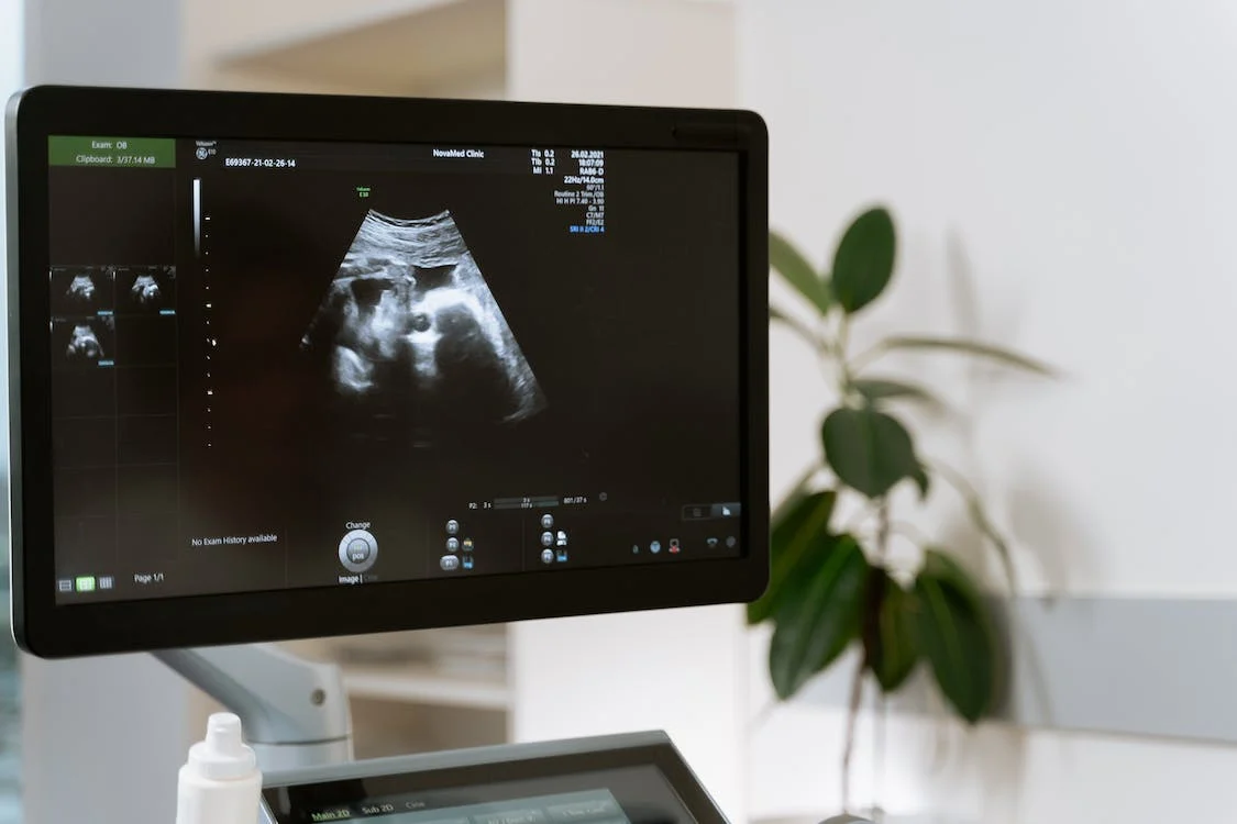 interconception period health