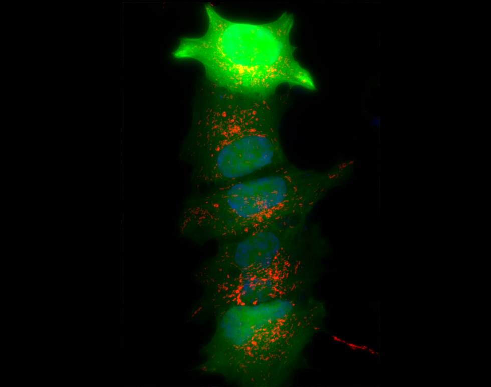 GFP at the top of the tree - Naomi Thorne