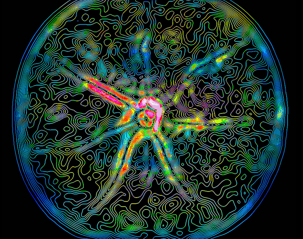 Disco Retina - Anna Muir (winner)