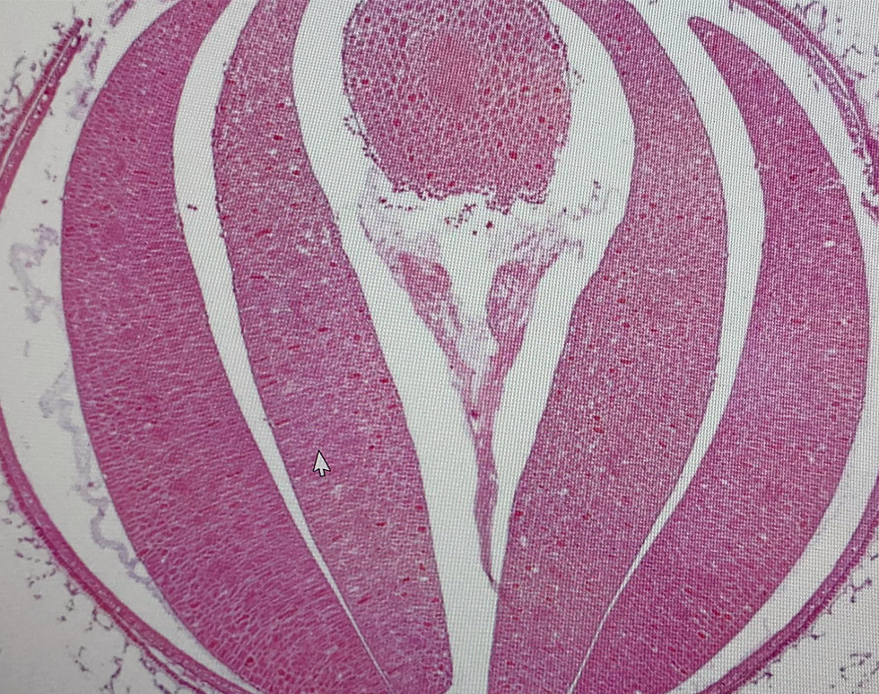 Colonic Bauble - Eleanor Jaynes