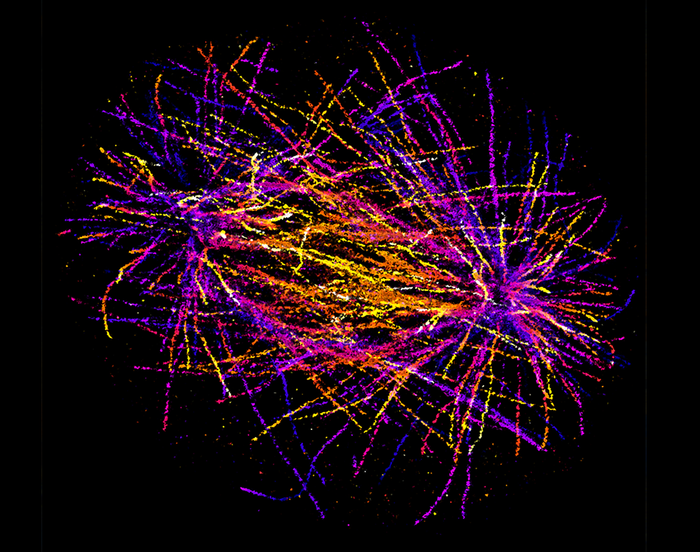 Tubulin fireworks - Ewan Reed